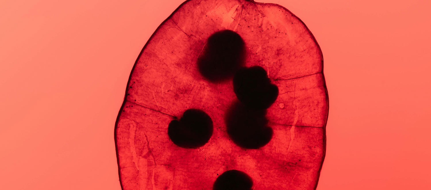 Mensch und KI, ein logischer evolutionärer Prozess